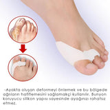 MG07 - Slikon Bunyon Koruma, Baş Parmak Destekleyici Slikon Koruma Pedi, Erkekler ve Kadınlar İçin Yumuşak Parmak Koruyucu Ped