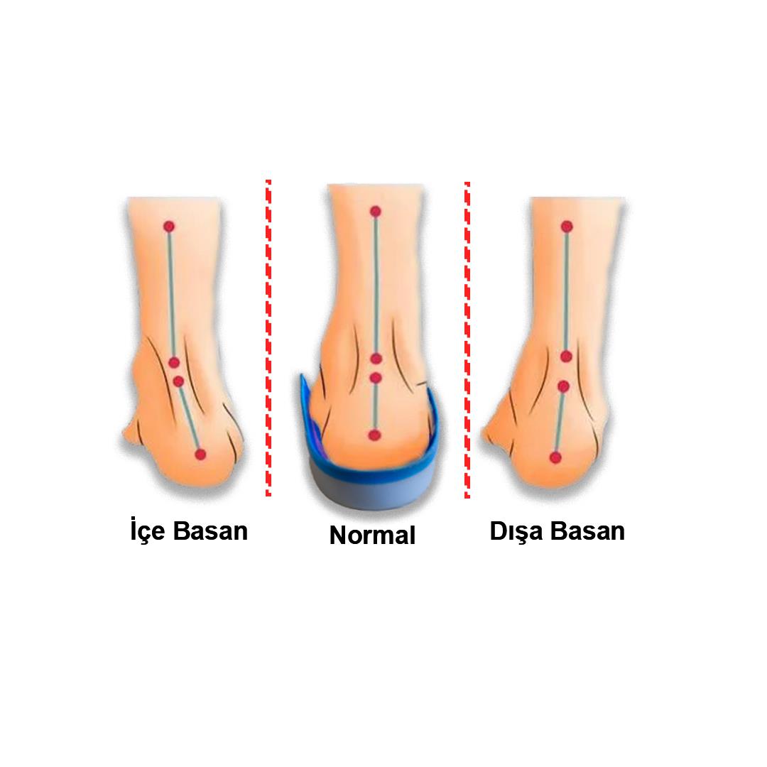 MG17 Ortopedik UCBL Tabanlık