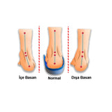 MG17 Ortopedik UCBL Tabanlık
